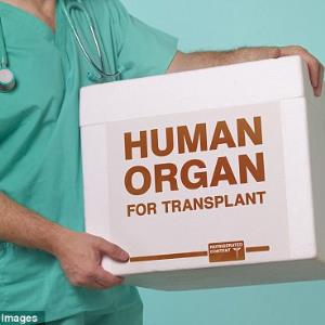 Organ Donation in New Zealand.