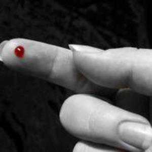 LA Injection: A young patient who cannot hold still