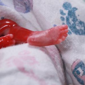 Is a 4 year old capable of viewing a miscarried baby of 18 weeks gestation?